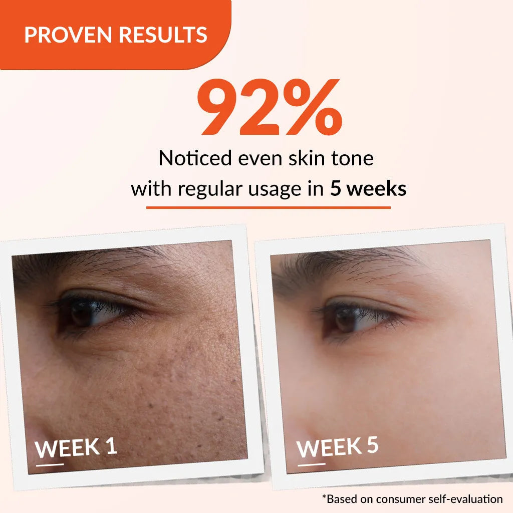 Fixderma Skarfix-TX Cream | Effective treatment for melasma and dark spots (30g)