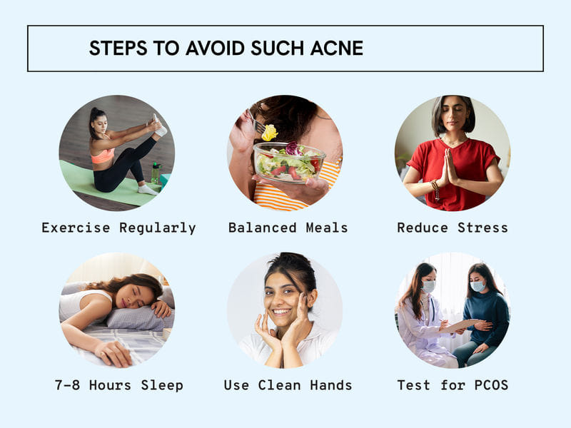 Be Bodywise 2.5% Benzoyl Peroxide Facewash