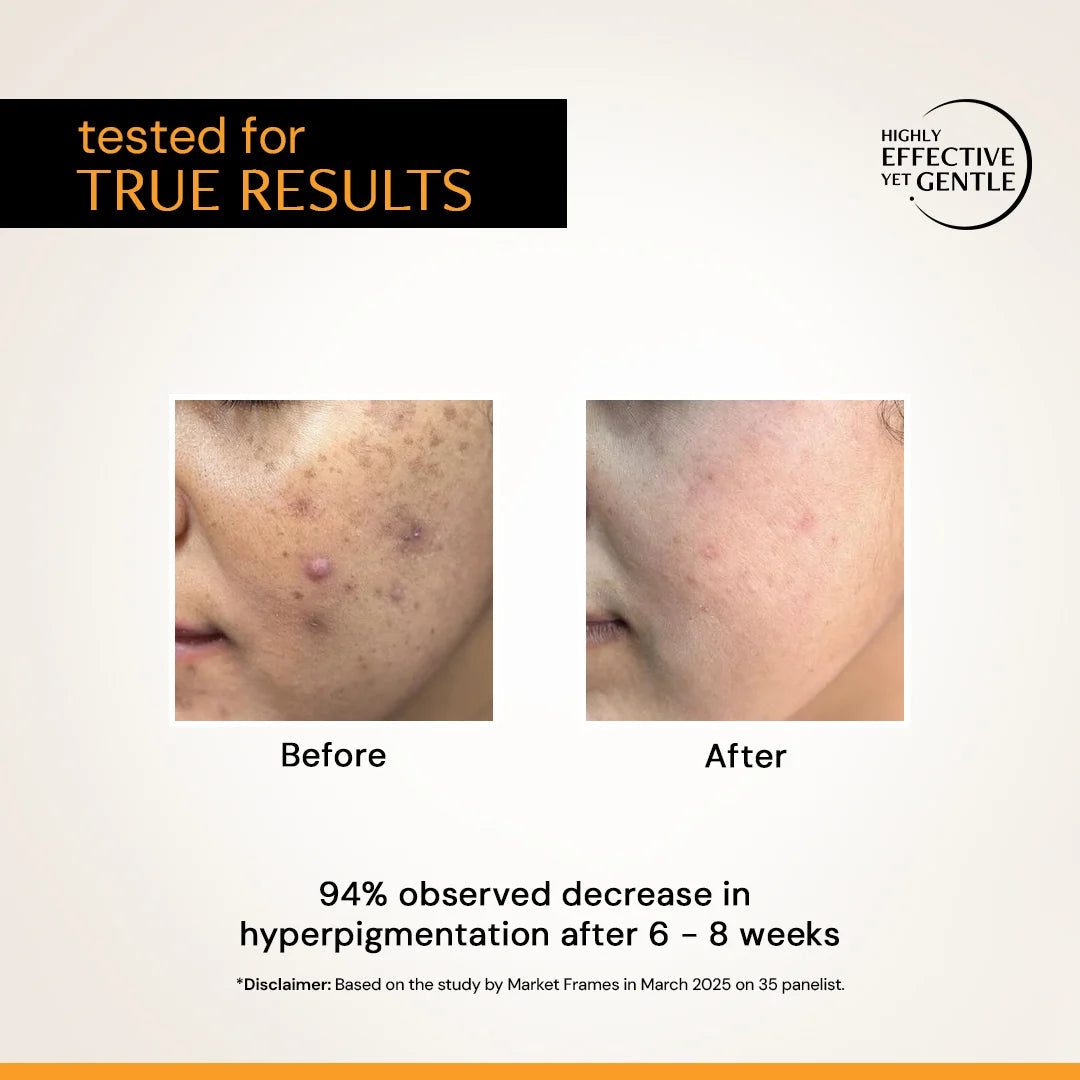Deconstruct Vitamin C Serum For Face - 10% Vitamin C + 0.5 % Ferulic Acid 30ml