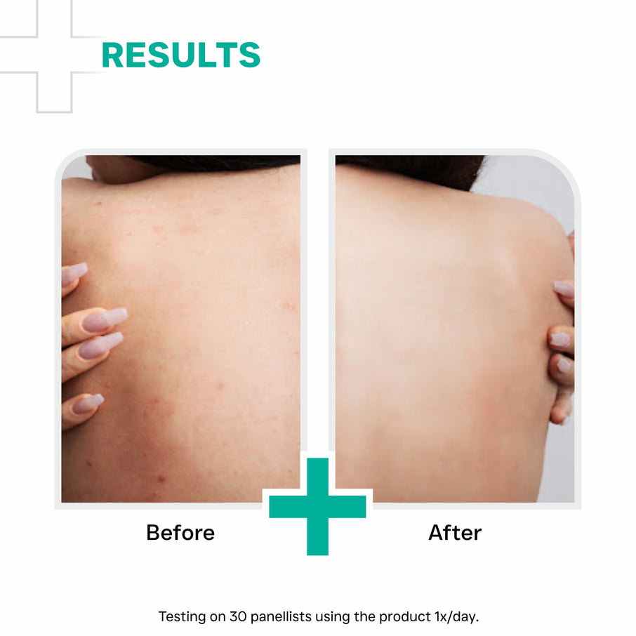 Dermatouch AHA 10% BHA 1% Body Lotion 200ml