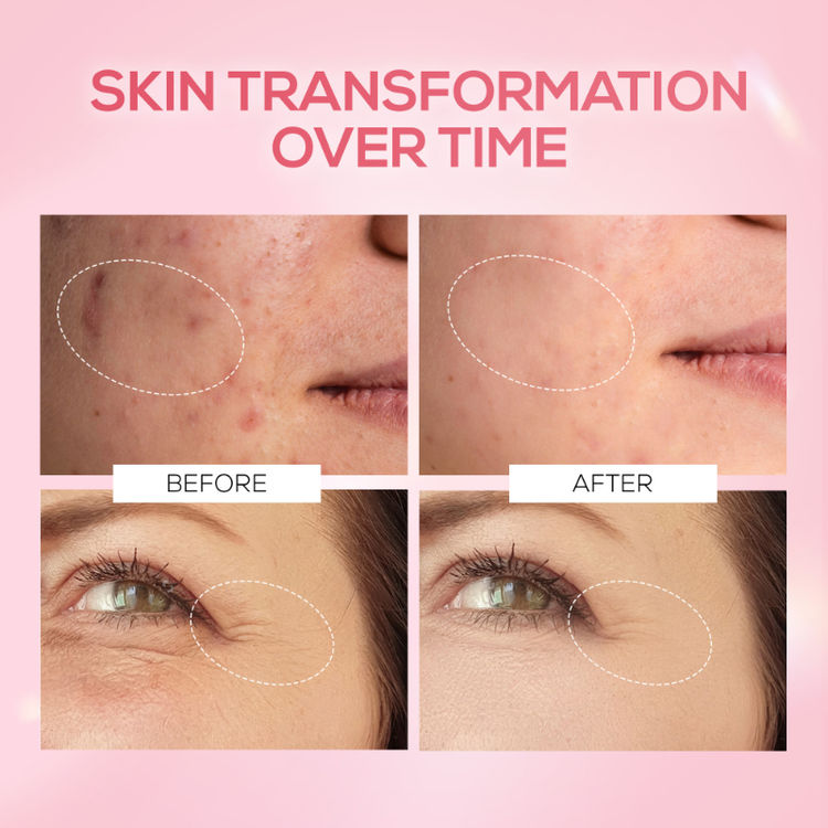 RENEE Pink Therapy PDRN Pink Peptide Serum For Radiant Skin, Hydrating, Hyaluronic Acid Infused
(30ml)