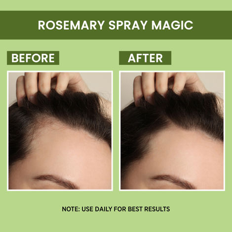 Alps Goodness Rosemarry Water | 100ml