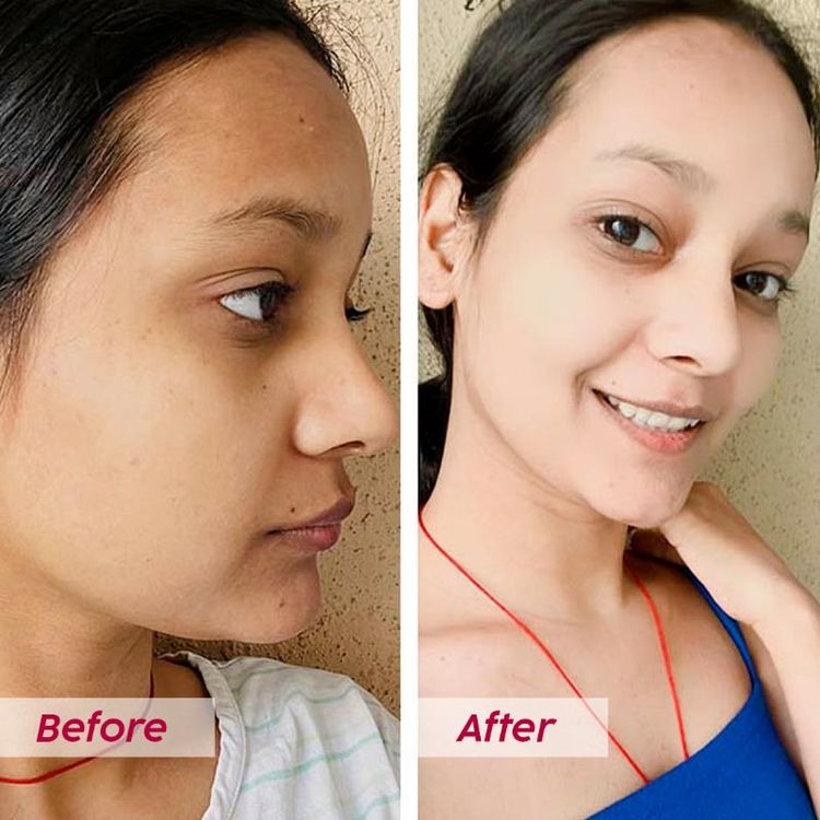 Plix Glutathione Skin Glow 15 Effervescent Tablet 500mg for Clear & Youthful Skin
(57 g)