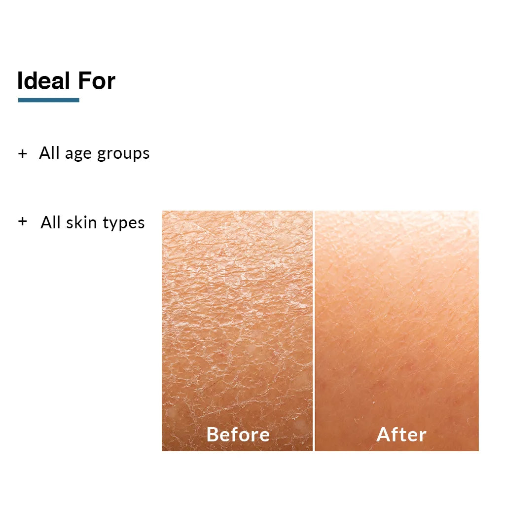 Fixderma Moisturizing Lotion | Perfect Solution To Provide Optimal Hydration For Dry Skin