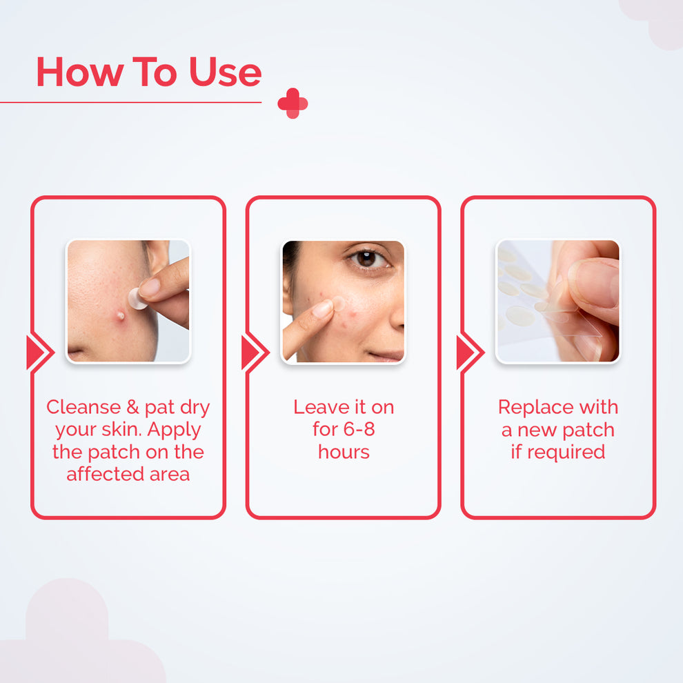 The Derma Co 2% Sali-Cinamide Hydrocolloid Acne Patches - 36 Patches
