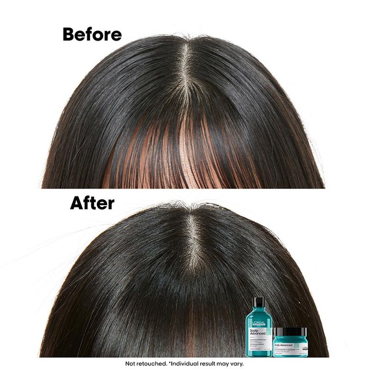 LOreal Professionnel Scalp Advanced Anti-Oiliness 2-In-1 Shampoo & Mask Deep Purifier Clay For Very Oily Scalp (250ml)