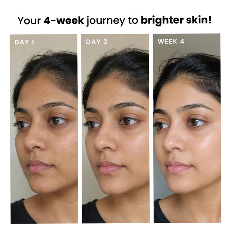 Foxtale Brightening Moisturiser with Vitamin C & Niacinamide, Fades Dark Spots, Dullness & Hydrates
(50ml)
