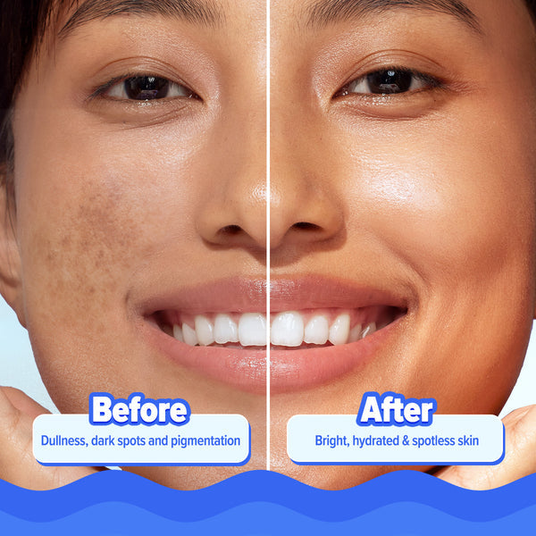 Aqualogica Bright+ Hydra Gel Moisturizer with Blueberry & Kojic Acid - 200 g