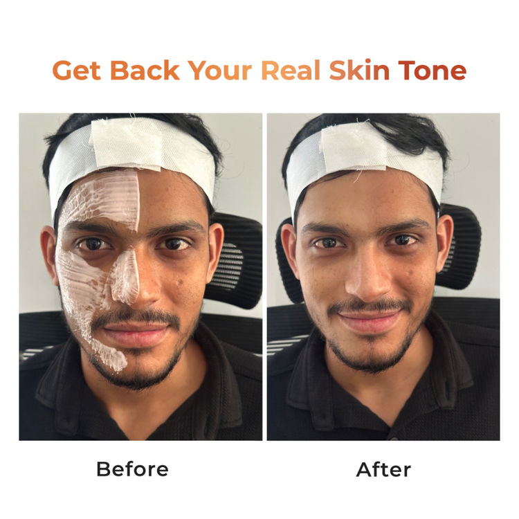 Niconi Tan Vanish Gluta-Kojic Skin Polish (180g)