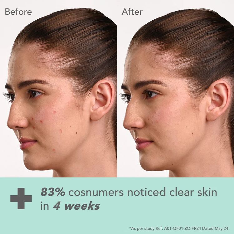 Lotus Herbals Lotus Dermabotanics Kojic Acid + Multi Berry Ampoule Face Cream pH5.5 Suitable For Sensitive Skin (50g)