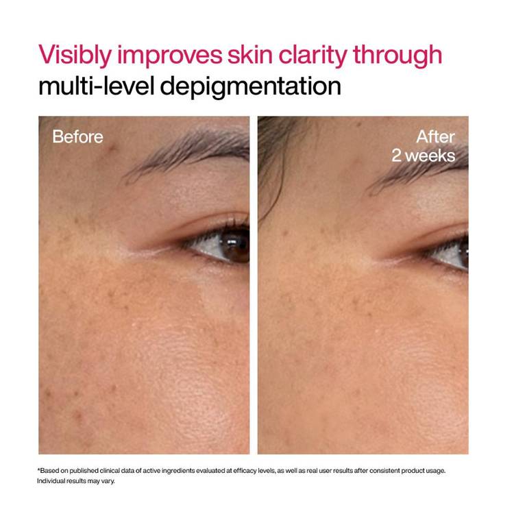Wishcare Advanced Dark Spot Correcting Txa Shot Serum (30ml)