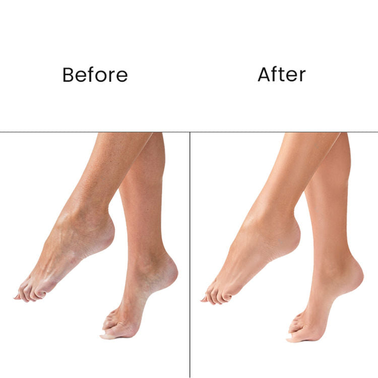 O3+ Pedilogix Scoop Bomb Pedicure With Bath Bomb
(100g+10ml)