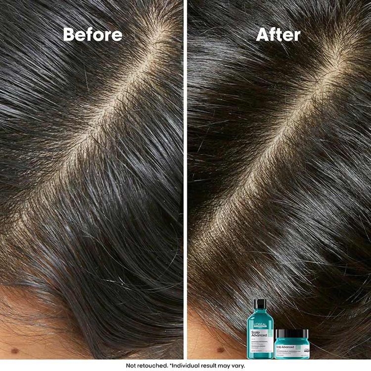 LOreal Professionnel Scalp Advanced Anti-Oiliness 2-In-1 Shampoo & Mask Deep Purifier Clay For Very Oily Scalp (250ml)