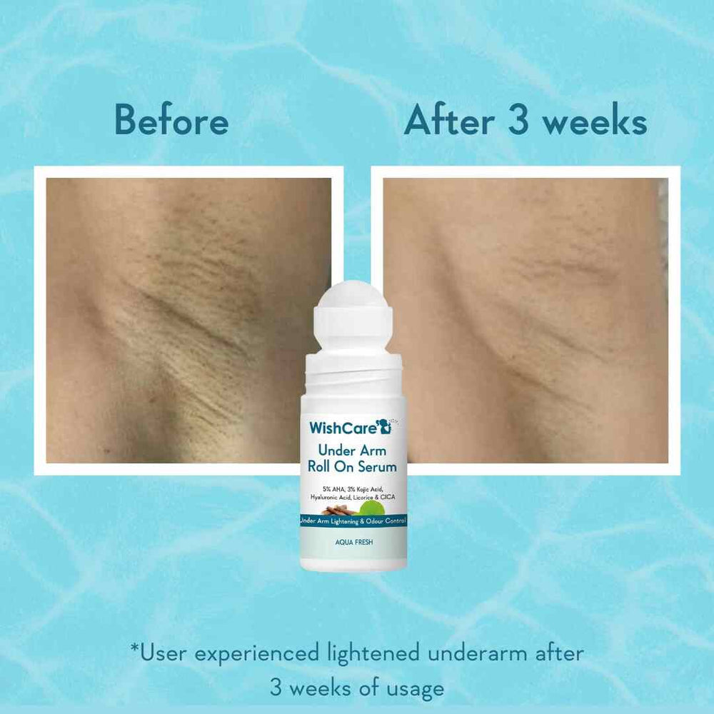 Wishcare Under Arm Roll On Serum
Controls Body Odour & Brightens Pigmentation | 50ml