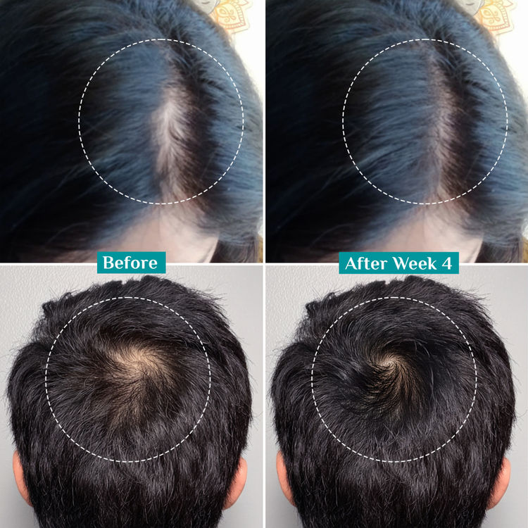 Pilgrim Advanced Hair Growth Serum Roll-On
(25ml)