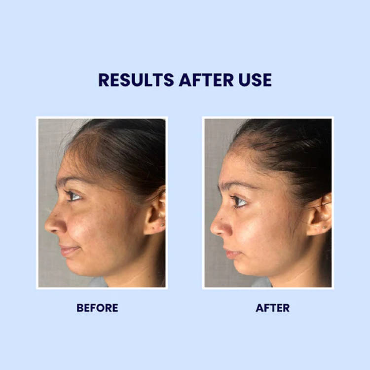 SUROSKIE Gluta Boost Face Wash for Men & Women With Niacinamide for Skin (100ml)