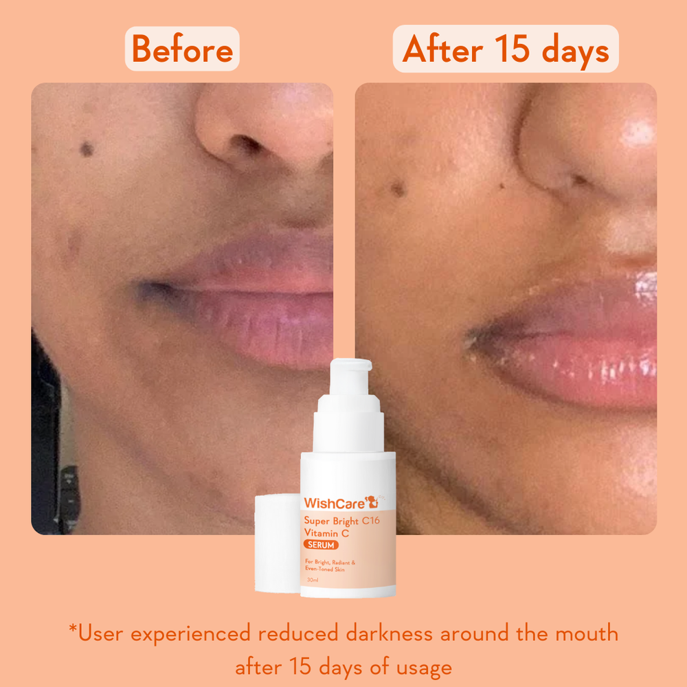 Wishcare Super Bright Vitamin C16 Serum
