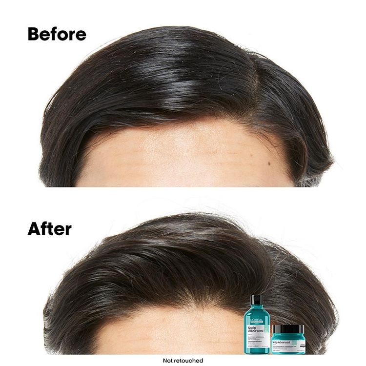 LOreal Professionnel Scalp Advanced Anti-Oiliness 2-In-1 Shampoo & Mask Deep Purifier Clay For Very Oily Scalp (250ml)