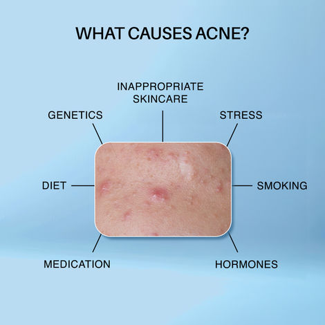 DERMDOC 2% Salicylic Acid Face Wash (120 ml)