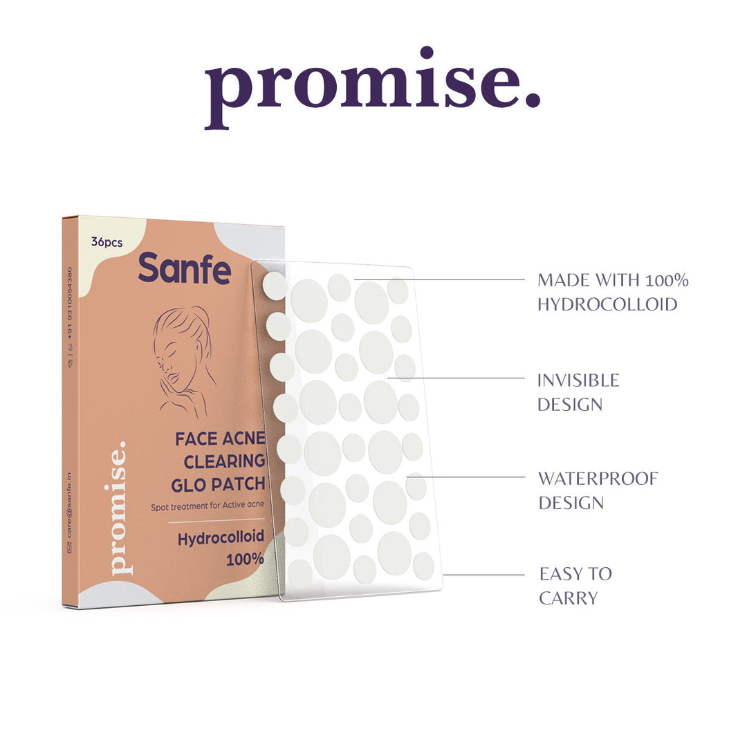 Sanfe Face Acne Clearing Glo Patch - Pack of 36