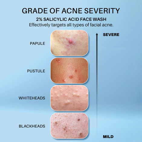 DERMDOC 2% Salicylic Acid Face Wash (120 ml)