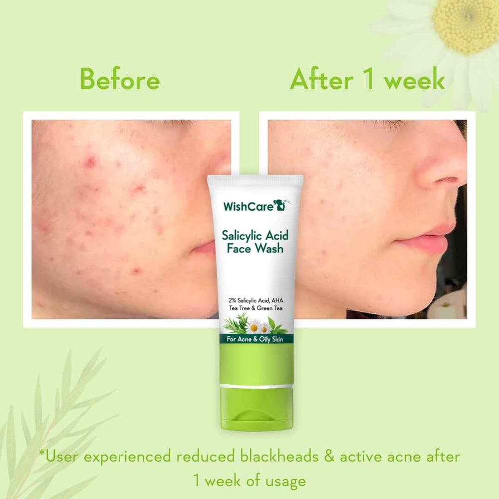 Wishcare 2% Salicylic Acid Face Wash
