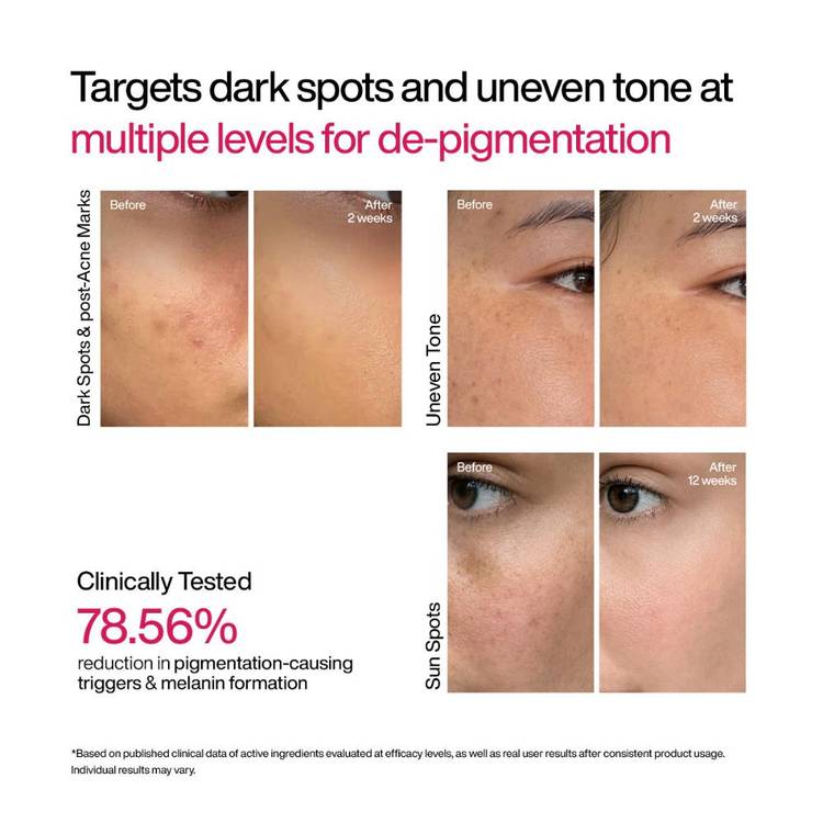 Wishcare Advanced Dark Spot Correcting Txa Shot Serum (30ml)