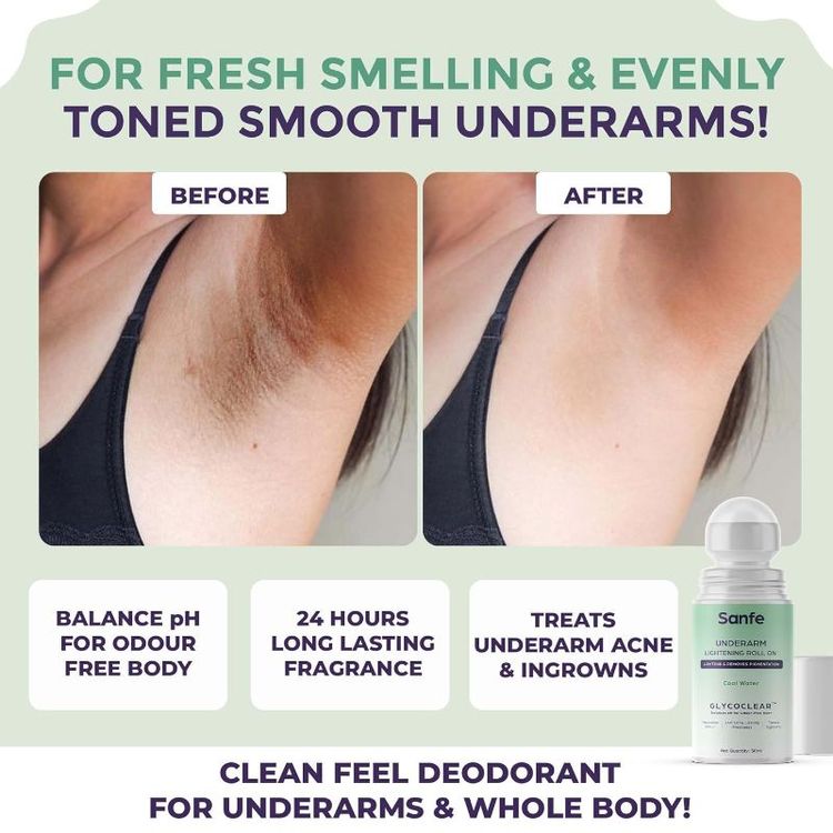 Sanfe Underarm Lightening Roll On With 5% AHA, Glycolic Acid & Salicylic Acid For Women
(50ml)