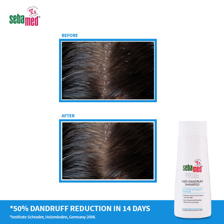 Sebamed Anti Dandruff Shampoo
(200ml)