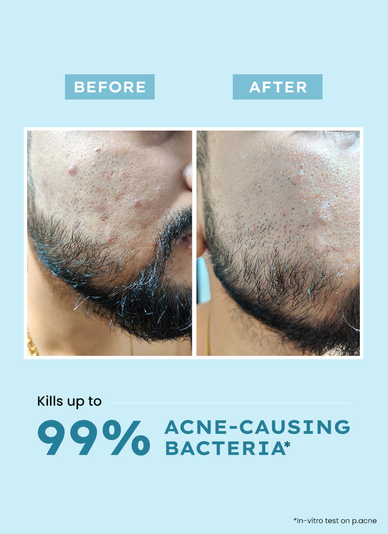 Hyphen Clarifying acne cleanser with 2% salicylic acid - 100 ml