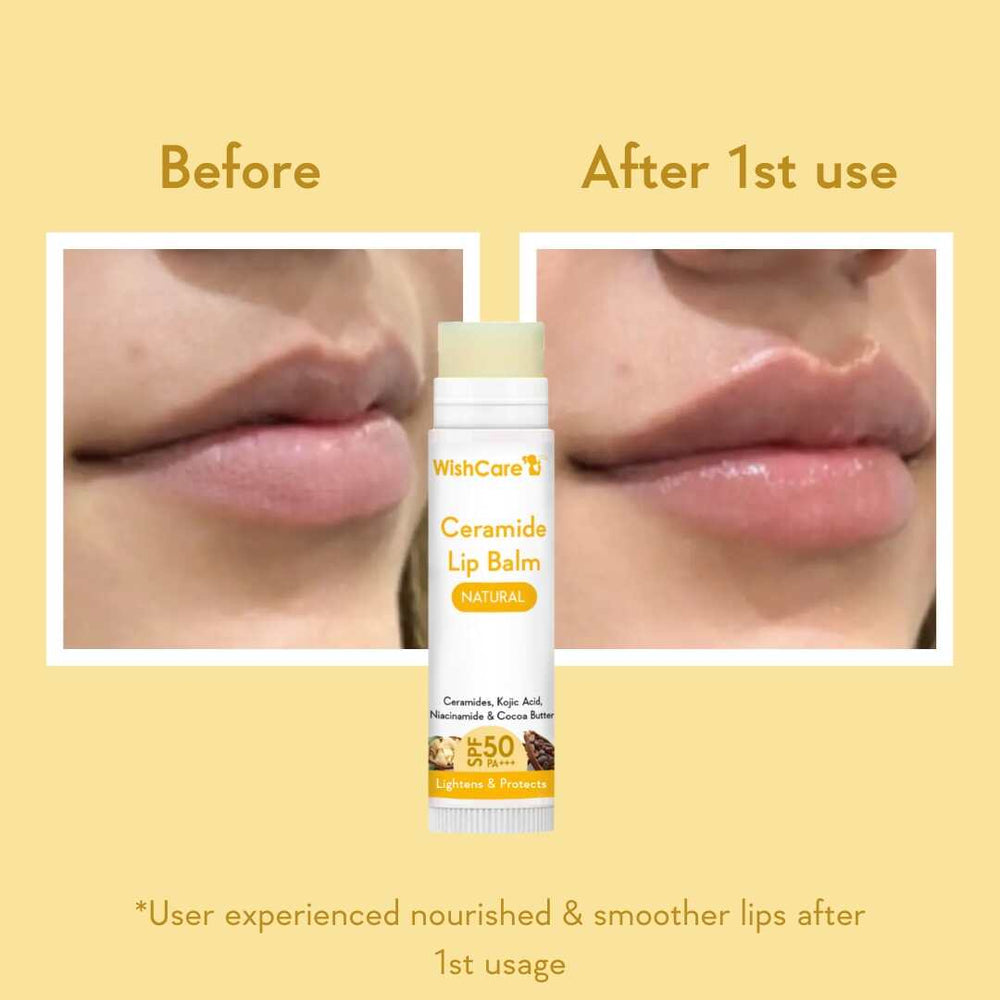 Wishcare Ceramide Lip Balm with SPF 50 PA+++ (Untinted)
SPF Infused Lip Balm for Lip Brightening | 5g