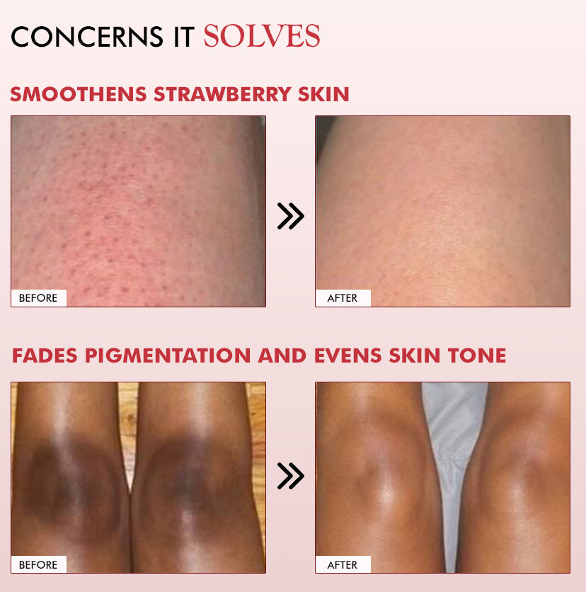 Mcaffeine 11% AHA BHA Strawberry Body Lotion for Skin Smoothening