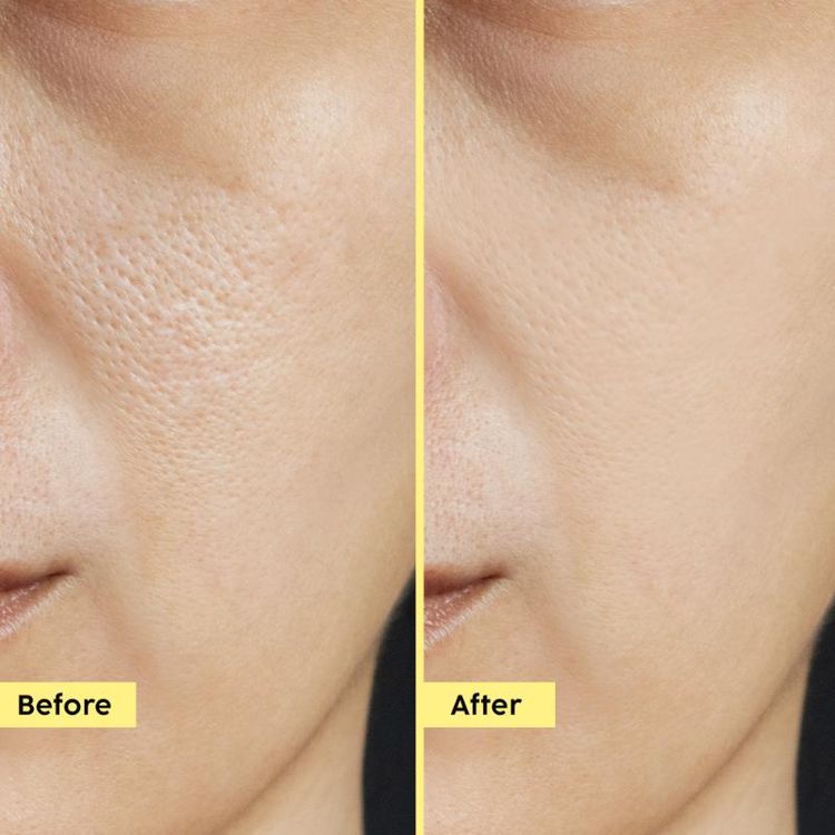 Plix Pineapple 3% Hyloglo PHA Alcohol Free Face Toner
(150ml)