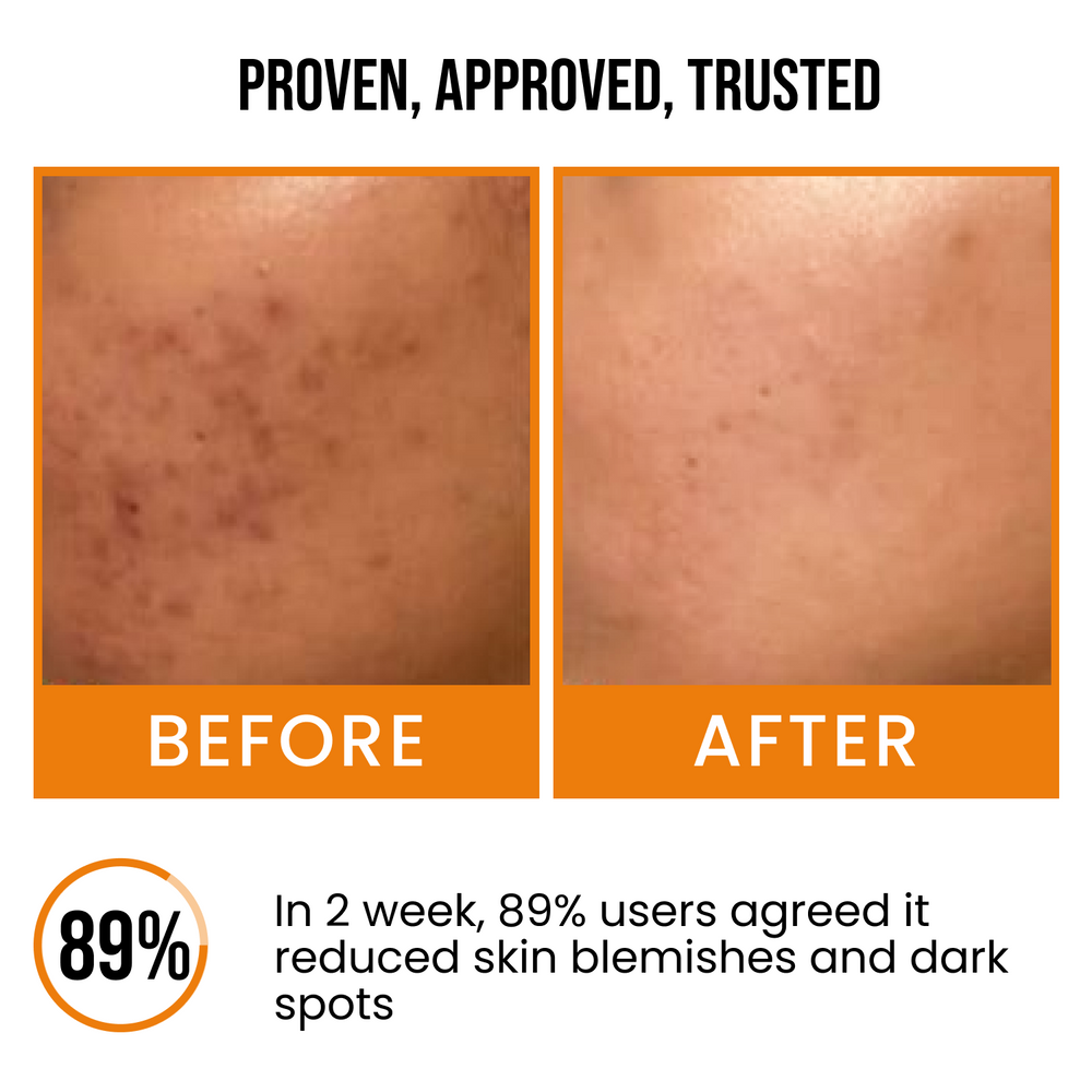 Insight cosmetics 18% Vitamin C Skin Brightening Face Serum