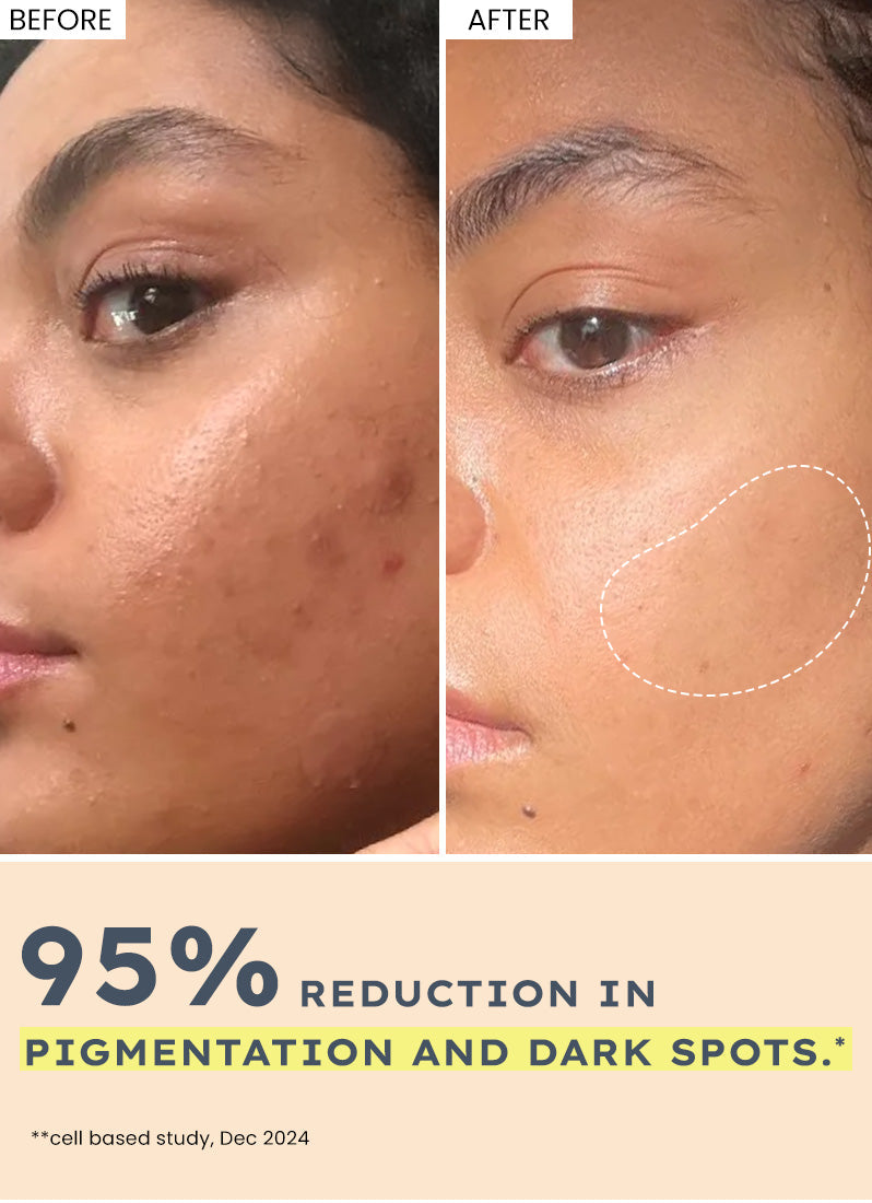 Hyphen Brightening serum pads with 44% rice water - 50 pads