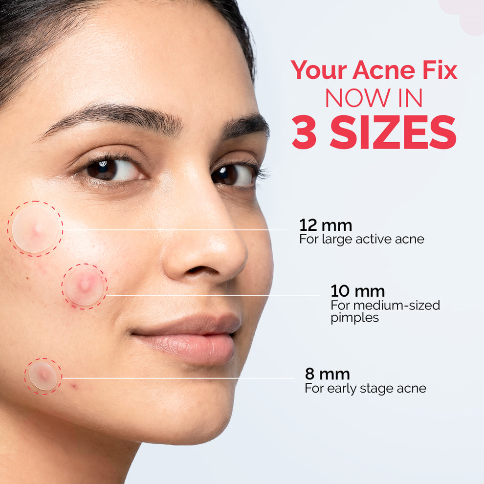 The Derma Co 2% Sali-Cinamide Hydrocolloid Acne Patches - 36 Patches
