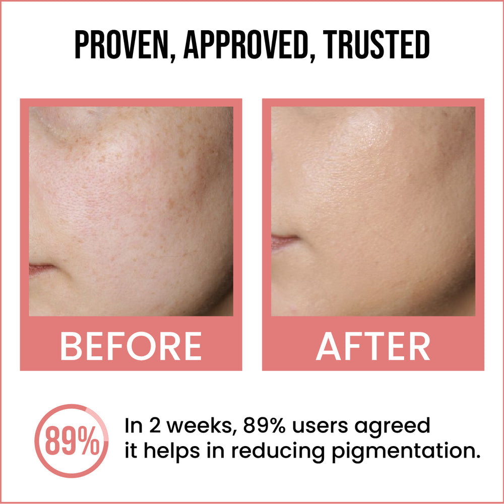 Insight cosmetics Brightening & Skin Repair Face Serum