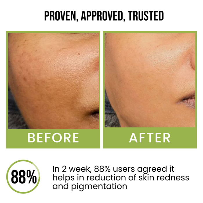 Insight cosmetics 10% Niacinamide Vitamin C Face Serum
