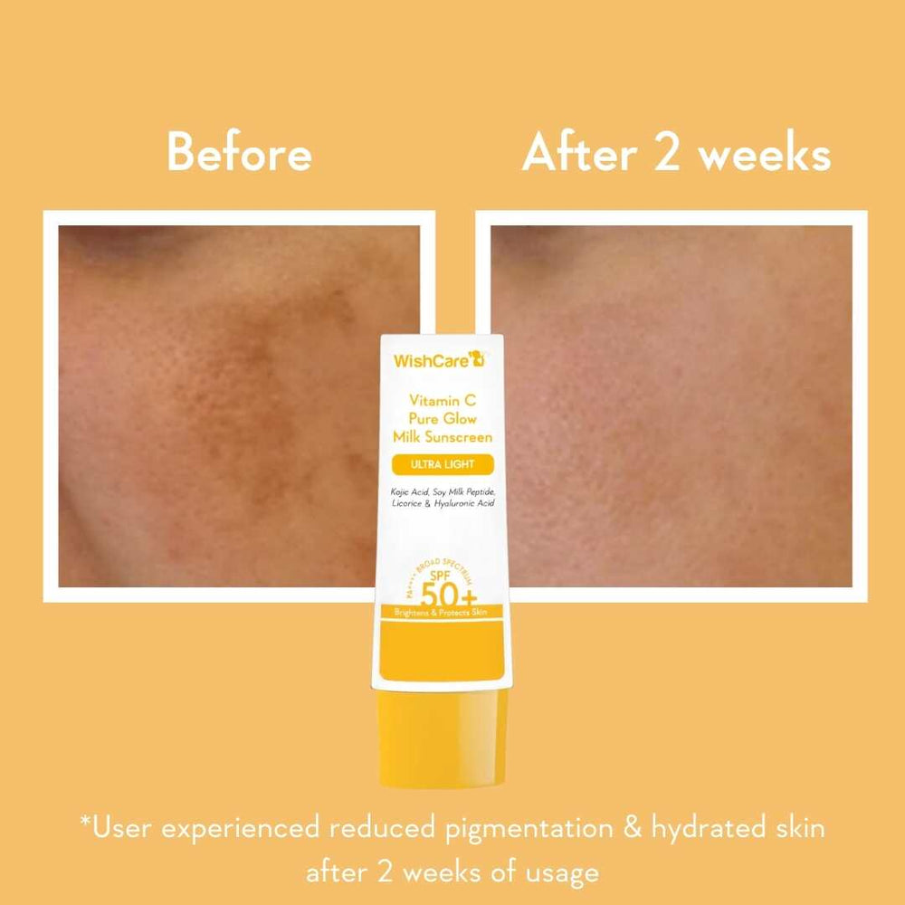 Wishcare Vitamin C Pure Glow Milk Sunscreen | SPF 50 PA++++
Lightweight Sunscreen with 8 hrs+ Sun Protection | 50gm