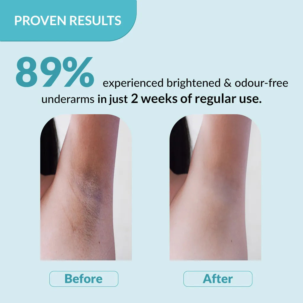 Fixderma Nigrifix Underarm Lightening Roll On | 6% AHA to Reduce Underarm Pigmentation in 2 Weeks (original)