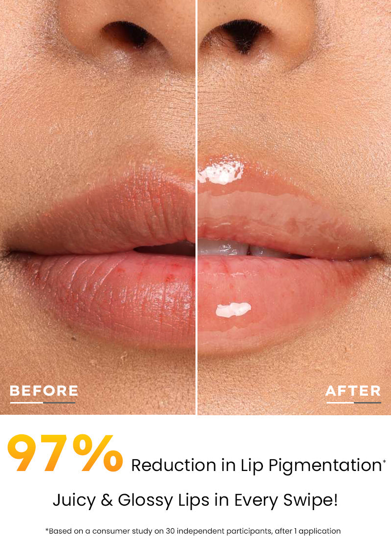 Hyphen Mango lip screen spf 50 pa++++ with 2% kojic acid
