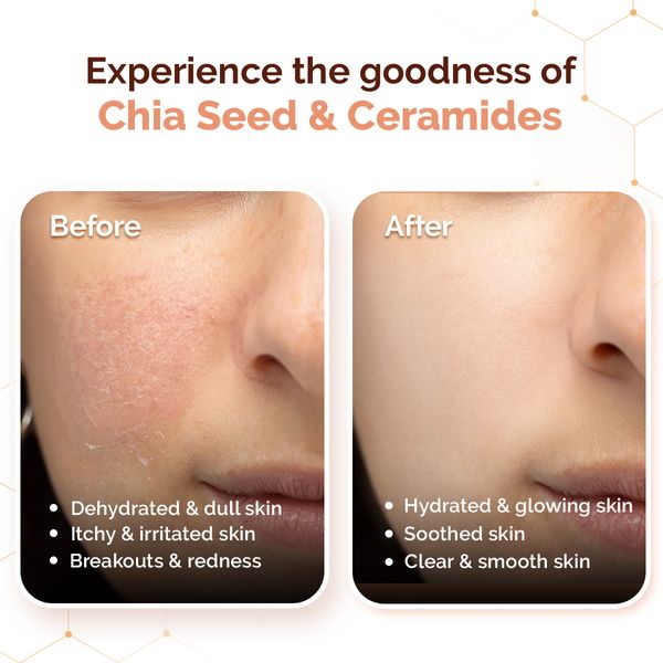 Mamaearth Chia Calming Moisturizer with Chia Seed & Ceramides for Healthy Skin Barrier - 80g