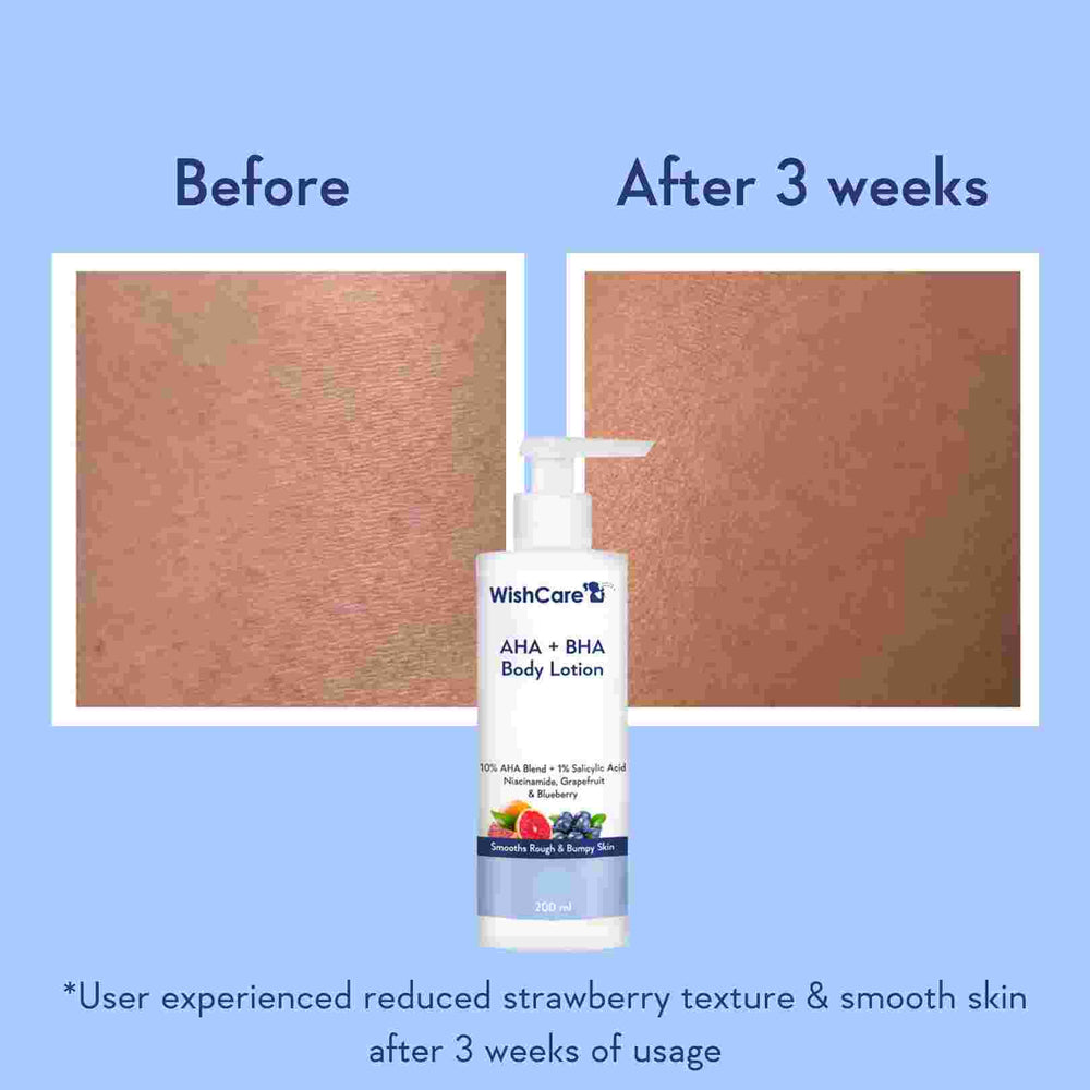 Wishcare AHA + BHA Body Lotion