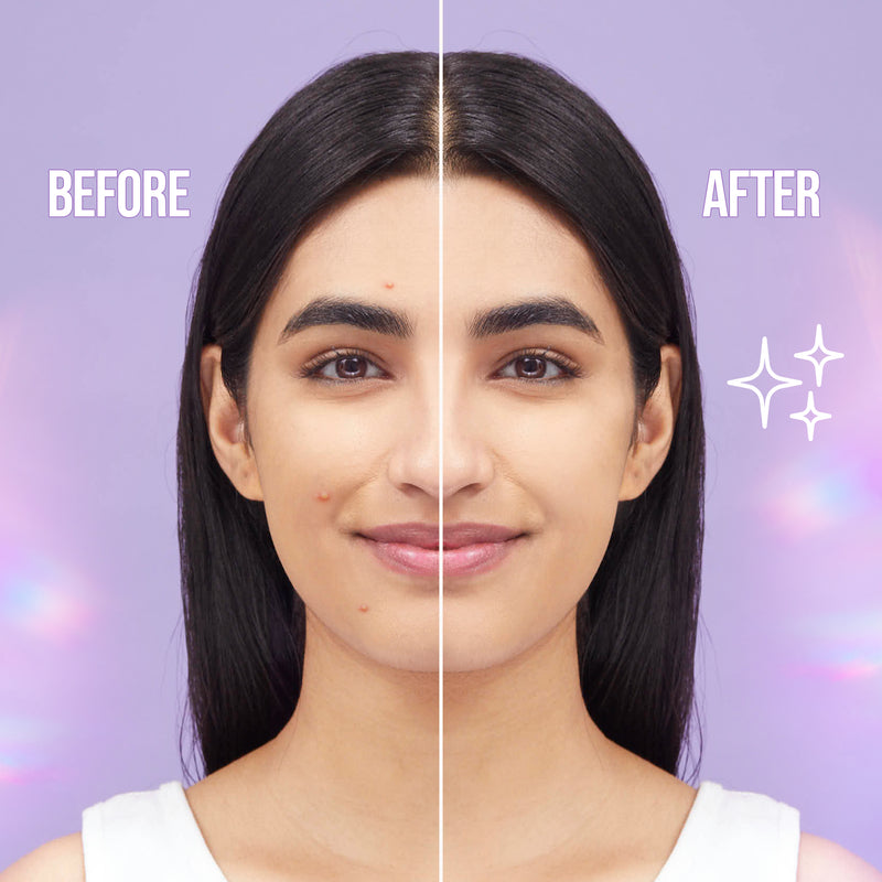 Hilary Rhoda Clear Skin Pimple Patch