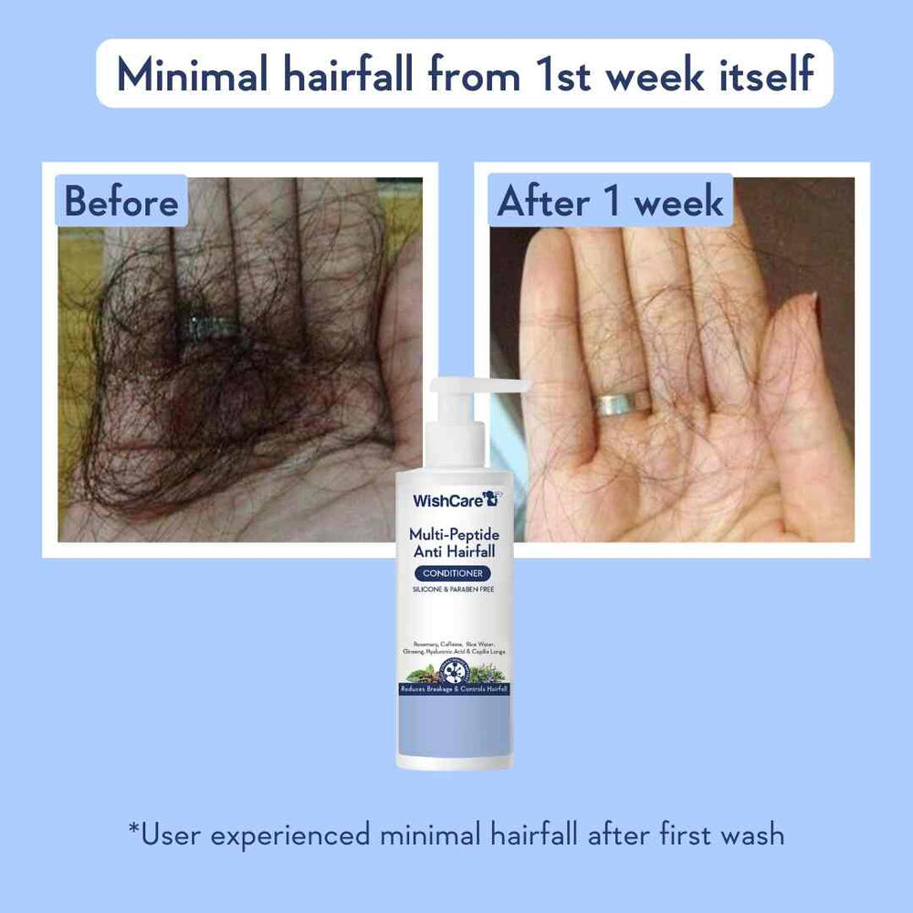 Wishcare Multi-Peptide Anti Hairfall Conditioner | With Rosemary
Conditioner for Frizzy Hair | Silicon and Paraben Free | 200ml