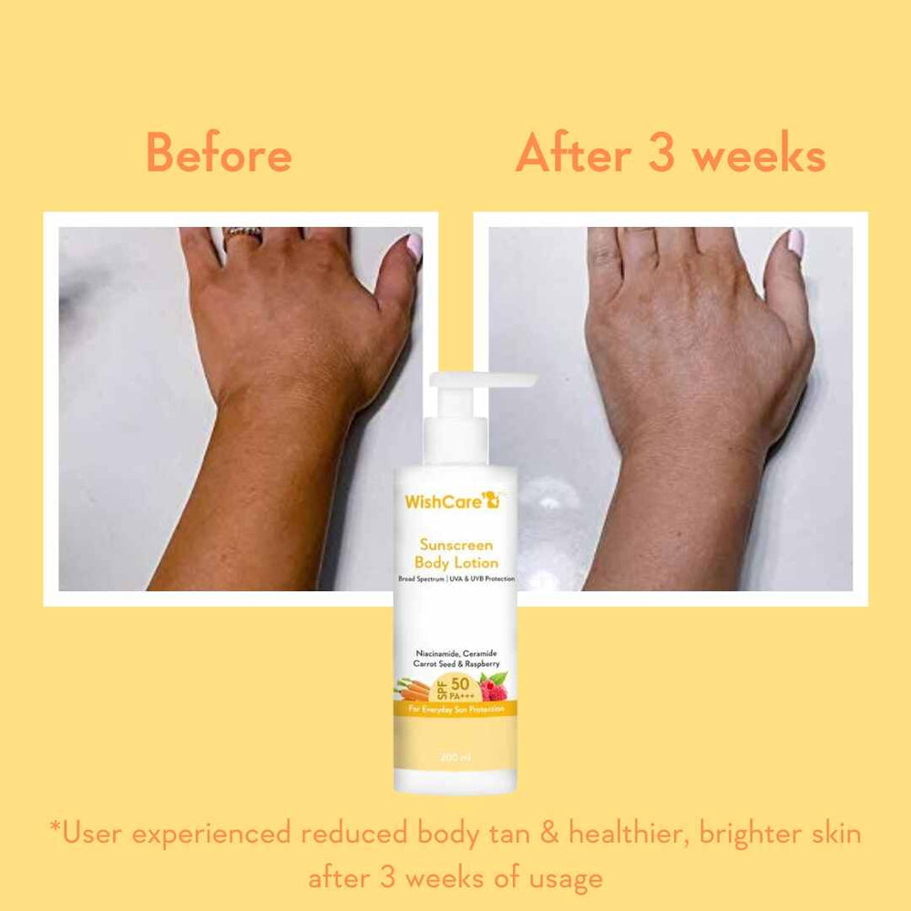 Wishcare SPF 50 Sunscreen Body Lotion PA+++
Prevents Body Tan with High UVA UVB Protection | 200ml