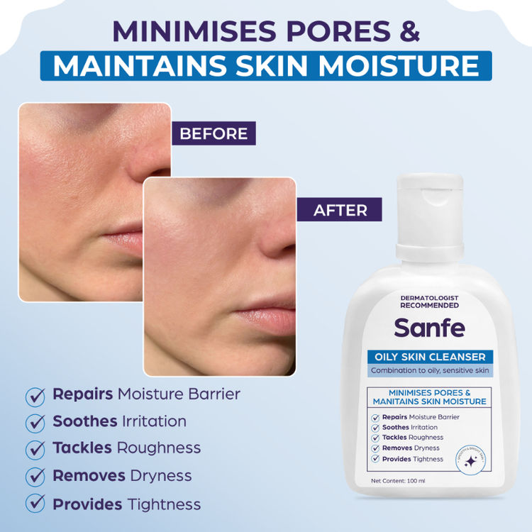 Sanfe Oily Skin Cleanser | For skin repair, dryness, tighter skin - For Oily, Acne Prone Skin, 100ml
(100ml)