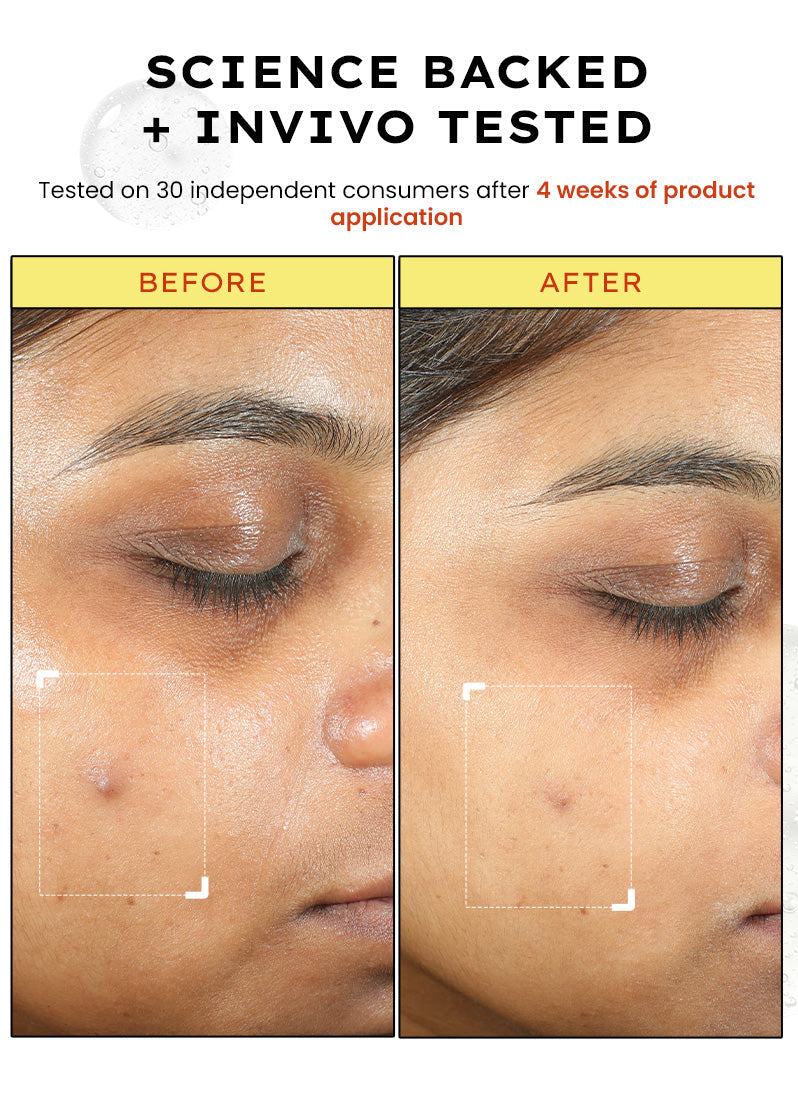 Hyphen 10% vitamin c serum with 1% [vitamin e + ferulic acid] - 20ml