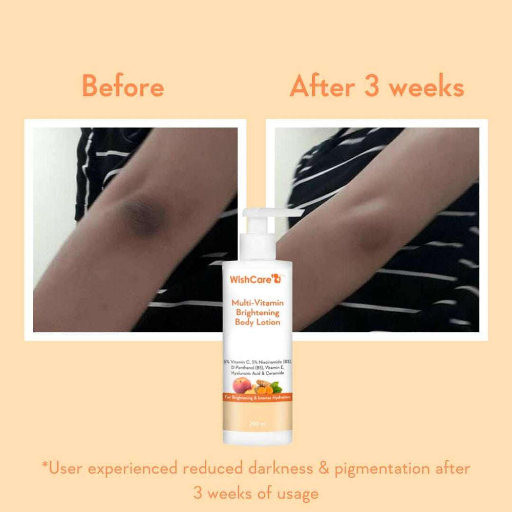Wishcare Multi Vitamin Brightening Body Lotion
For Bright & Even Tones Skin | 200ml