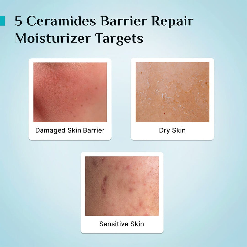 Pilgrim 5 Ceramides Barrier Repair Moisturizer